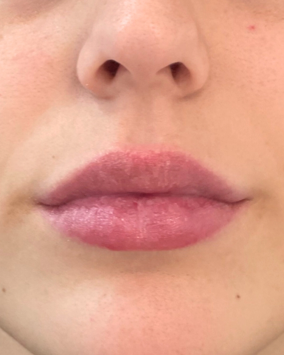 lips after lips after